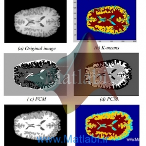 Improved fuzzy clustering approach Application to medical image MRI