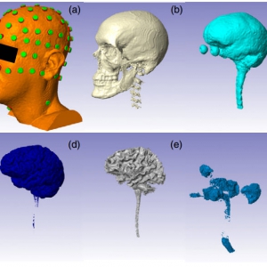 Automated MRI segmentation for individualized modeling of current flow in the human head